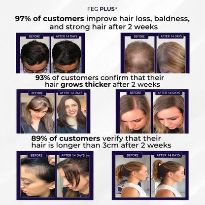 زيت نمو الشعر واللحية FEG plus Hair Growth Spray