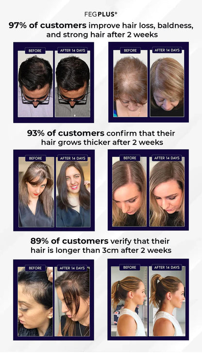 زيت نمو الشعر واللحية FEG plus Hair Growth Spray